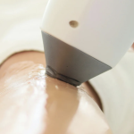 Full Body Laser Hair Removal Costs in Chevy Chase Maryland